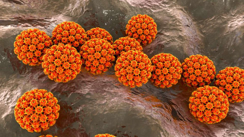 자궁경부암 01.png