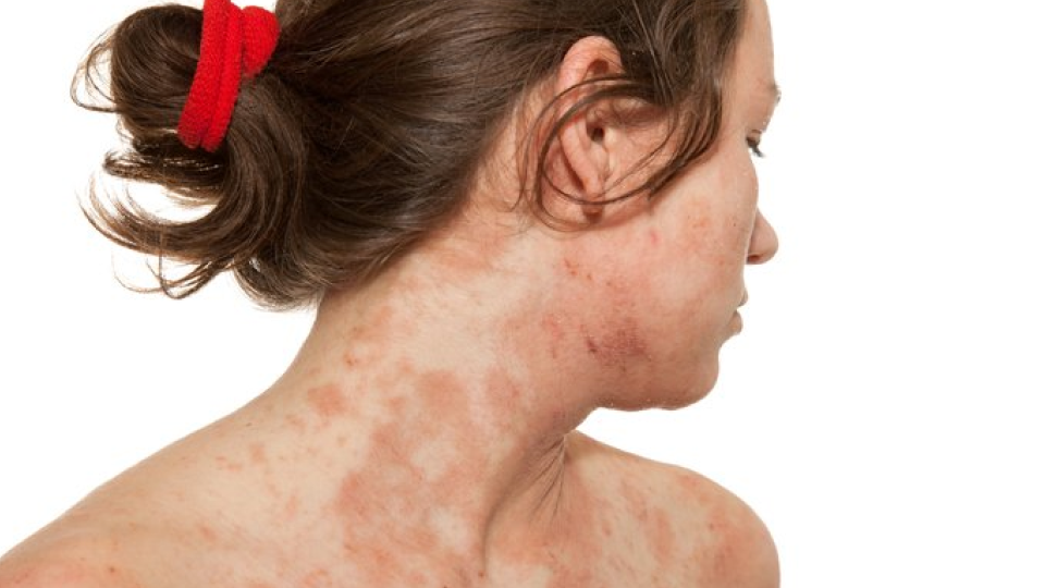 듀피젠트 01.png