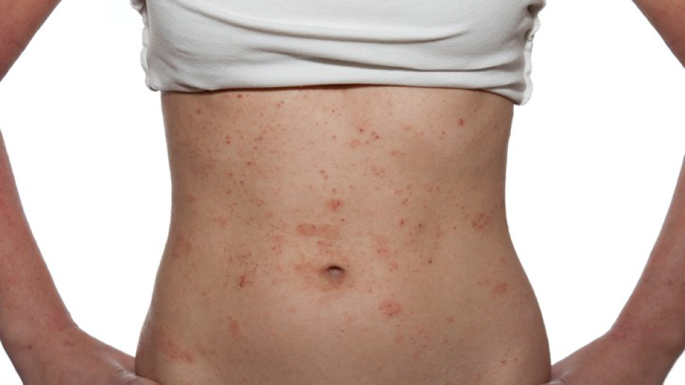 치료법 01.png