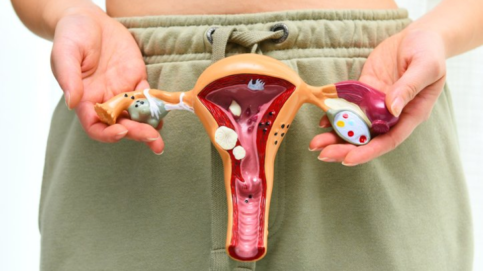 월경통 01.png