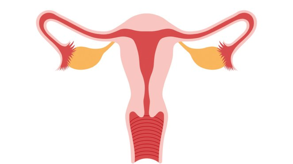 자궁근종 01.png