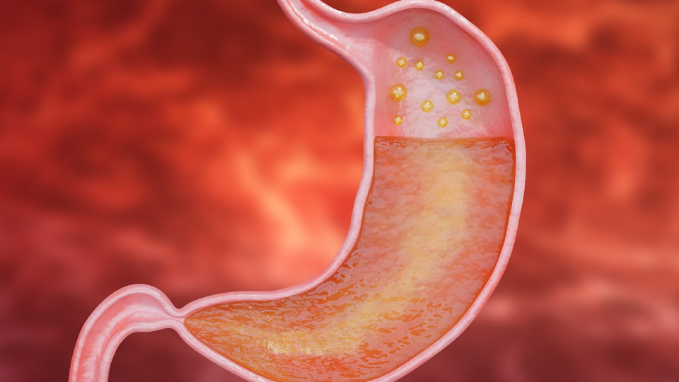 위염,신경성위염,만성위염,급성위염,출혈성위염,미란성위염,표재성위염,위염원인,위염치료,위염약,위염증상