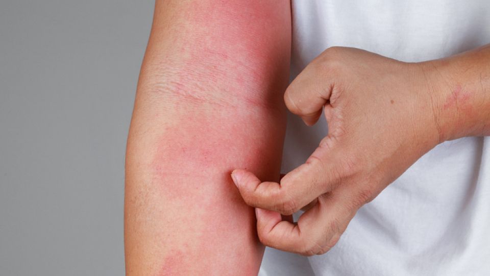 독감 예방 (1).jpg