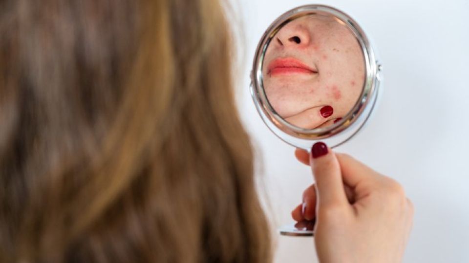 성형수술, 성형, 염증, 항생제, 자외선, 재생크림, 리프로덤겔