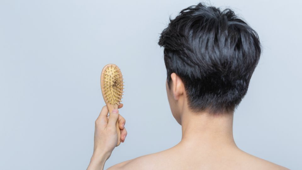 탈모, 유전성탈모, 스트레스