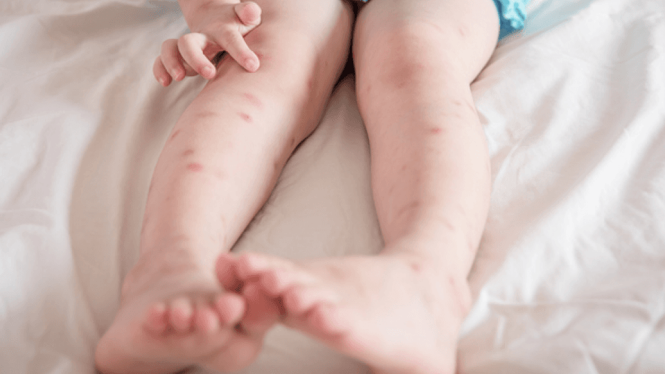 건강꿀팁 본문 이미지 (23).png