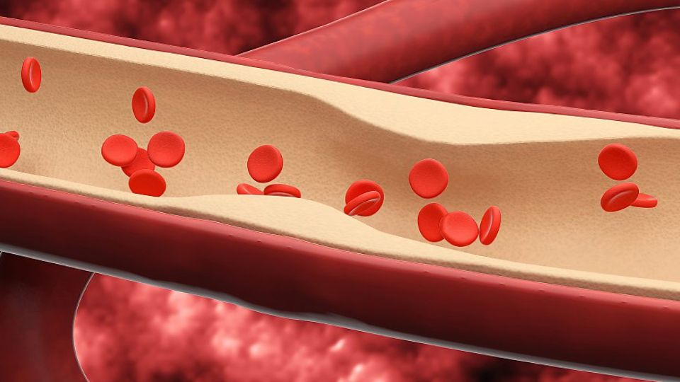 나트륨, 천일염, 정제염, 고혈압, 신장문제, 골다공증, 체중증가