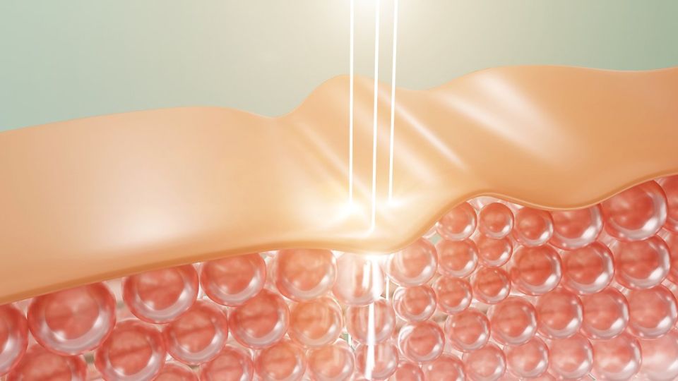 스티바A크림,스티바에이크림,스티바A크림처방,스티바A크림부작용,스티바A크림직구,스티바A크림후기,