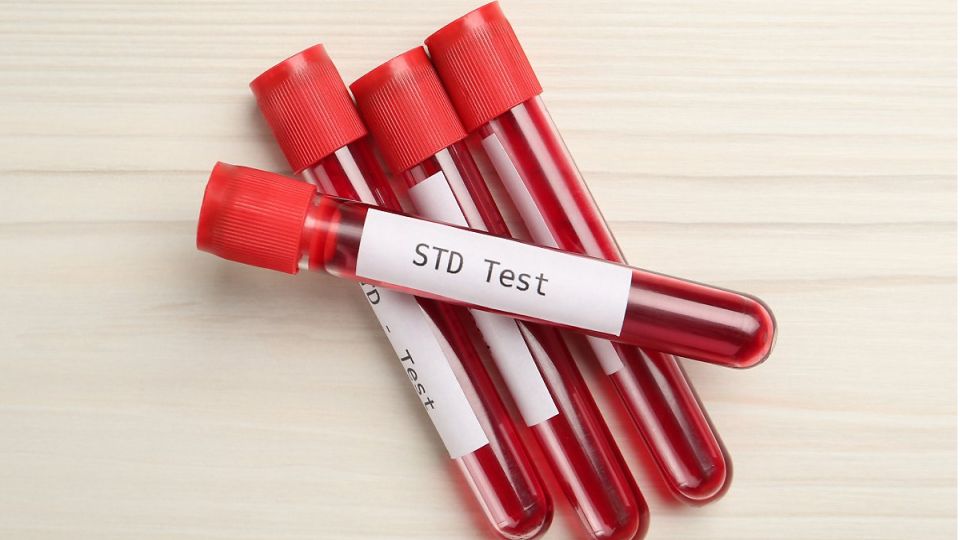 STD검사,헤르페스,질염,성병,성병균,공생균,매독,성병검사,임질,칸디다