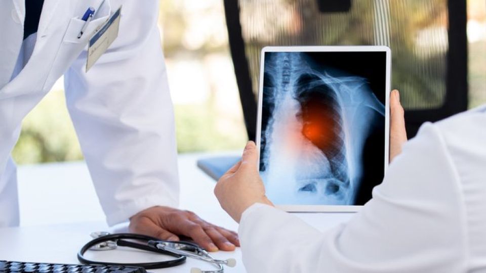 기생충, 폐결핵, 폐렴, 폐암, 호흡기질환, 호흡기, 호흡기건강, 폐렴예방, 폐렴증상, 폐결핵폐렴차이