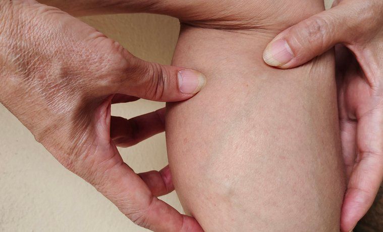 이코노미클래스 증후군2.jpg