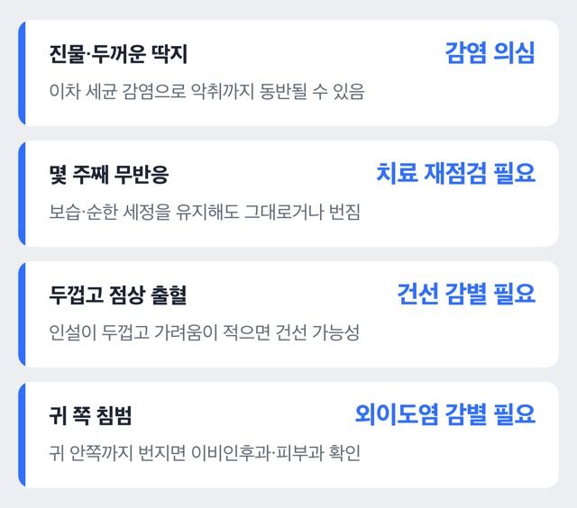 지루성피부염 병원 방문이 필요한 신호를 정리한 도표