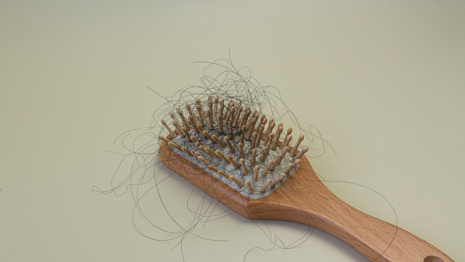 친자검사,친자검사원리,DNA,STR