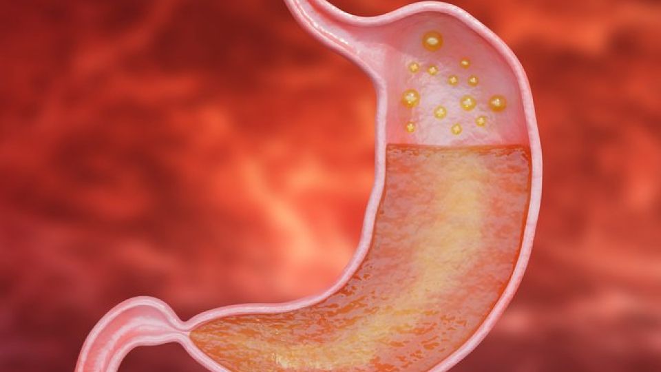 역류성식도염증상,역류성식도염비대면진료,역류성식도염치료,역류성식도염이란,역류성식도염,나만의닥터,역류성식도염나만의닥터,역류성식도염진료,
