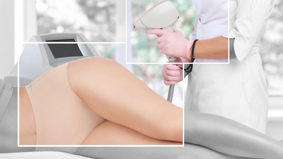 곤지름, 곤지름 증상,곤지름 치료, 곤지름 원인, hpv,가다실