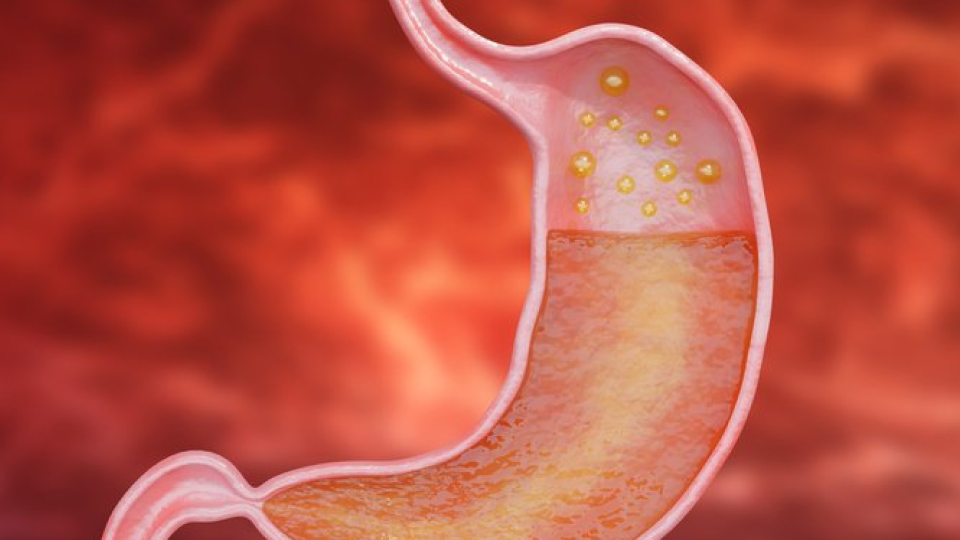 다이어트 3.png