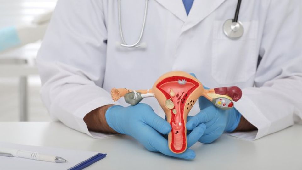 다낭성난소증후군,여성질환,비대면진료,생리불순,불임,월경불순,여드름,다모증,무월경,자궁출혈