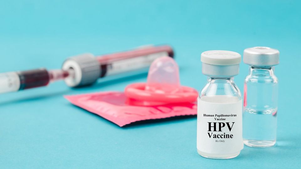 곤지름, 곤지름 증상,곤지름 치료, 곤지름 원인, hpv,가다실