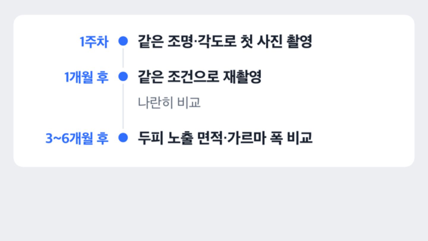 정수리 사진을 일정 간격으로 비교하는 타임라인 도해