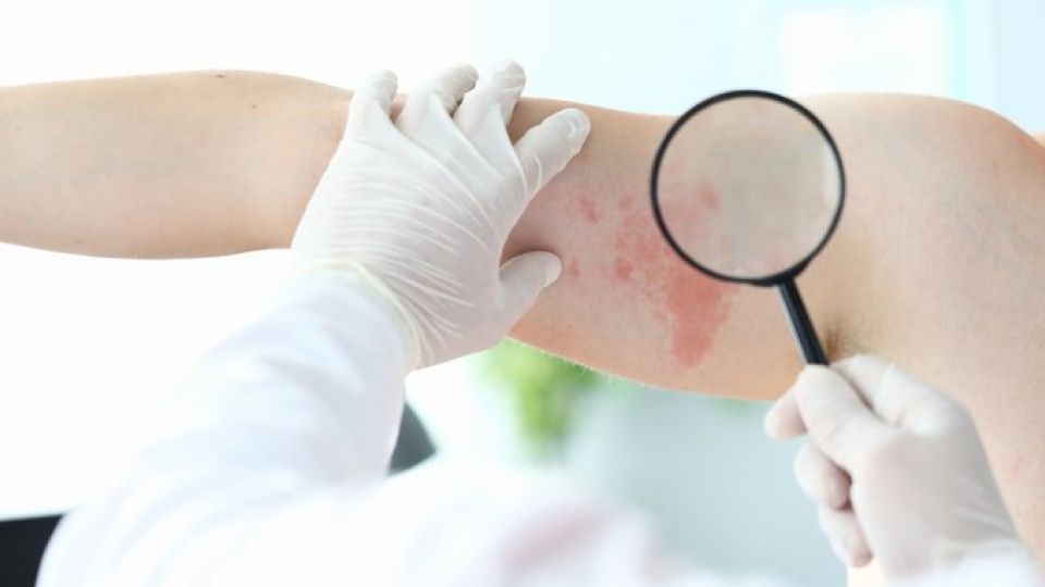 가다실, 성병, 자궁암, 자궁경부암, 가다실접종, hpv, 인유두종바이러스, 질암, 항문암, 곤지름