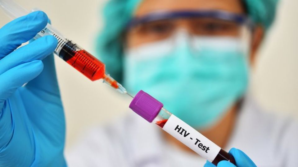 에이즈, 에이즈 원인, 에이즈 증상, 에이즈 원인, 에이즈 감염경로, 에이즈 증상, AIDS, HIV, 인체면역결핍바이러스