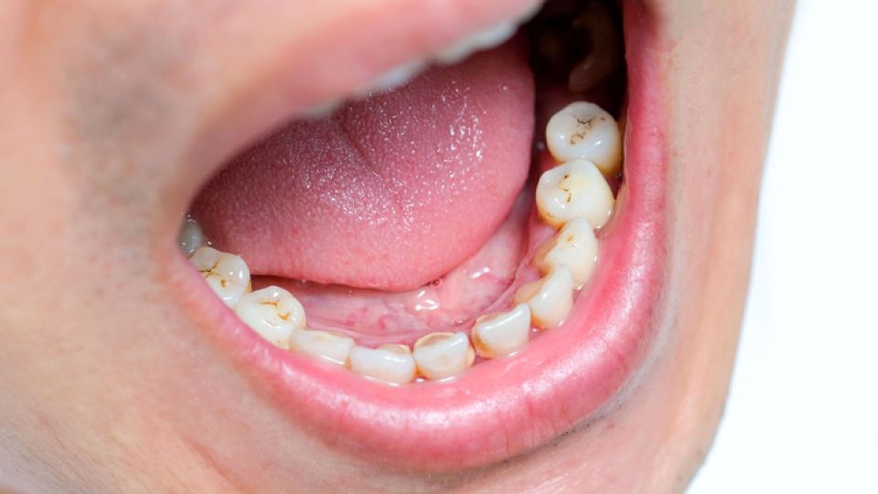 구강, 구강통증