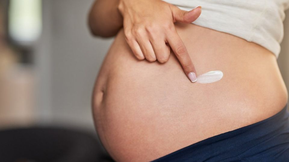 튼살, 튼살관리법, 튼살크림, 튼살제거, 튼살관리, 튼살치료, 튼살없애기, 튼살없애는법, 튼살예방