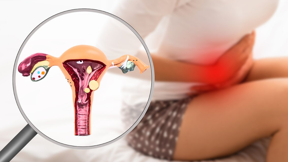 자궁경부암, 질암, 외음부암, 분비물, 출혈