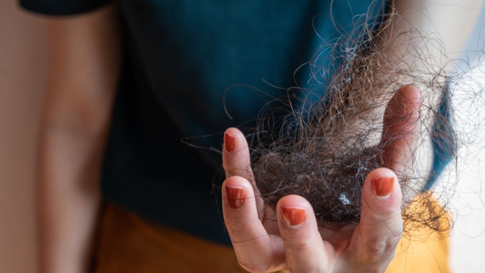 탈모, 탈모 종류, 탈모 진단법, 탈모 자가진단, 탈모 대처법, 탈모 치료법, 탈모 원인, 탈모 성지, 대면 탈모 성지