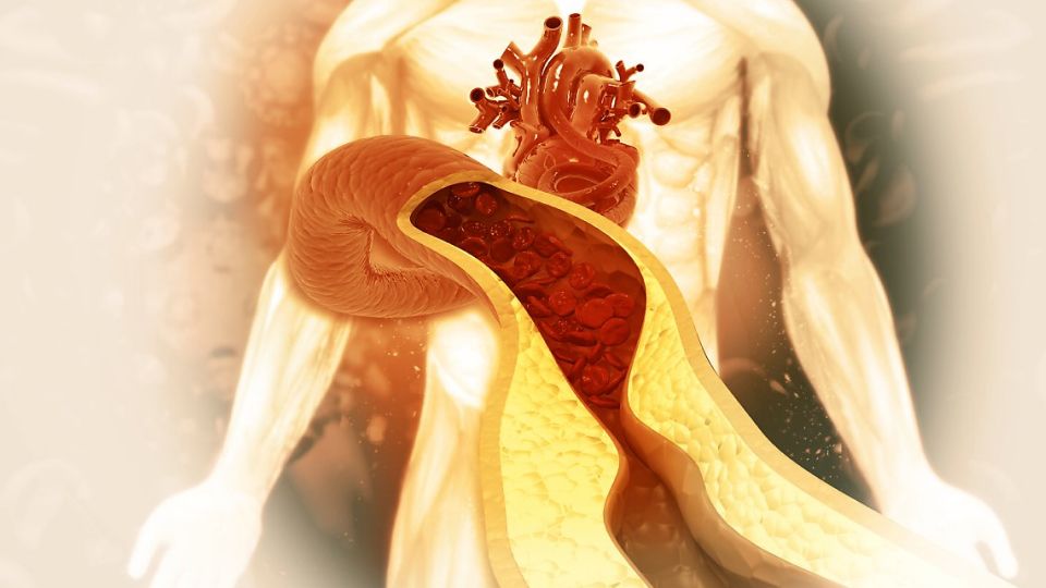 고지혈증치료, 고지혈증원인, 고지혈증약물치료, 고지혈증약, 고지혈증합병증, 고지혈증, 고지혈증진료, 고지혈증수치