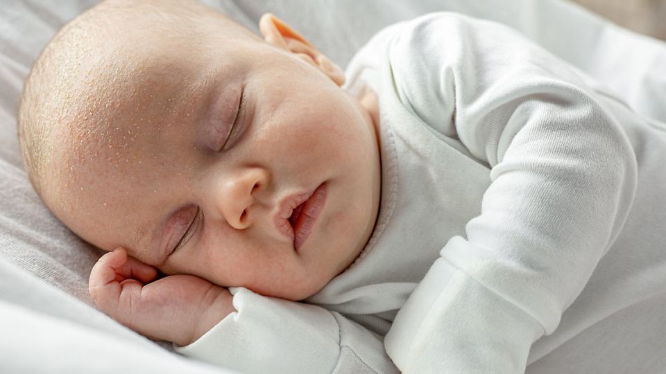 아토피, 아토피치료, 아토피초기, 아토피로션, 성인아토피, 아토피병원, 아토피원인, 아토피관리, 아토피증상