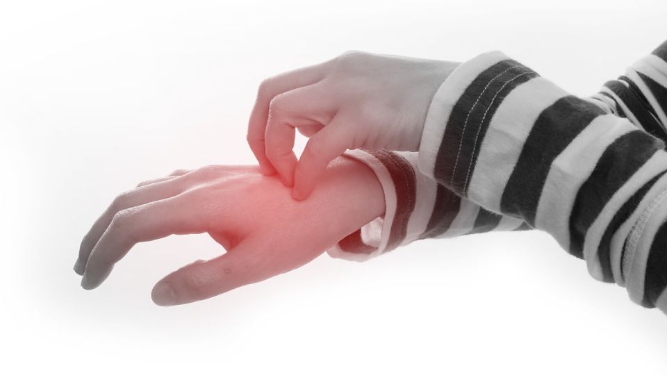 주부습진, 주부습진치료, 주부습진예방, 주부습진원인, 주부습진증상, 주부습진치료법, 주부습진예방법, 주부습진병원