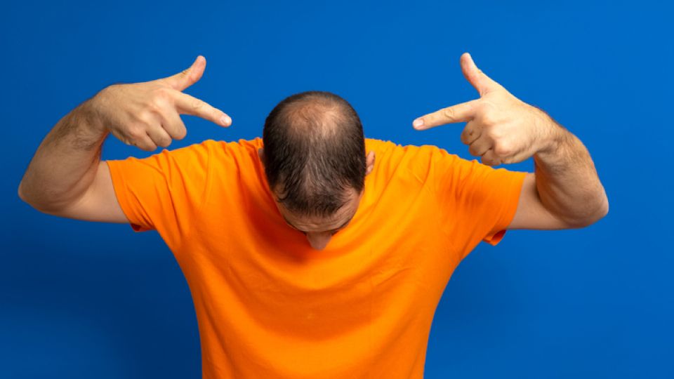 탈모, 탈모 종류, 탈모 진단법, 탈모 자가진단, 탈모 대처법, 탈모 치료법, 탈모 원인, 탈모 성지, 대면 탈모 성지