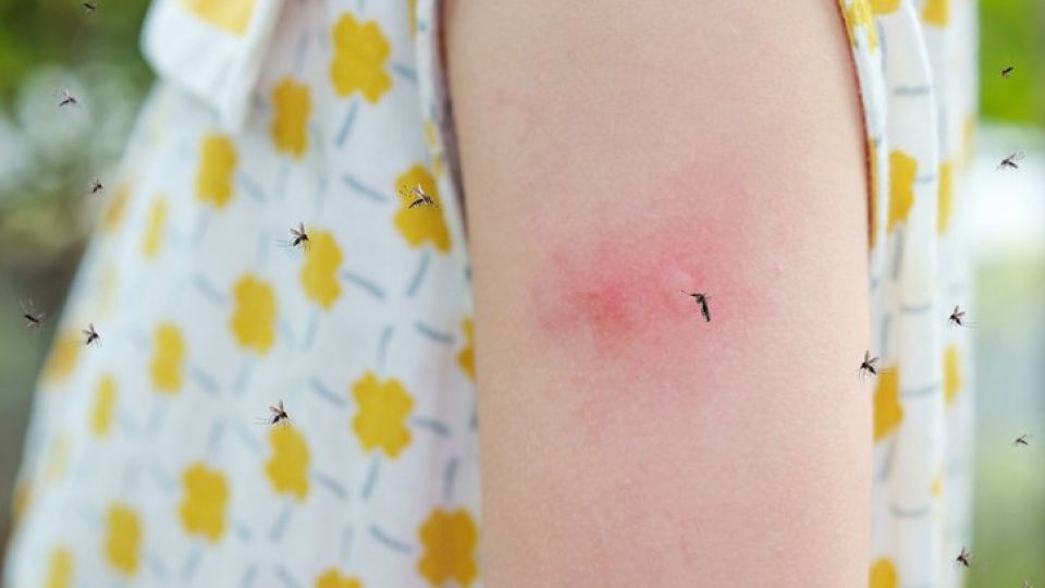 위생해충, 모기, 해충, 말라리아, 뎅기열, 바퀴벌레, 지네, 거미, 파리, 러브버그