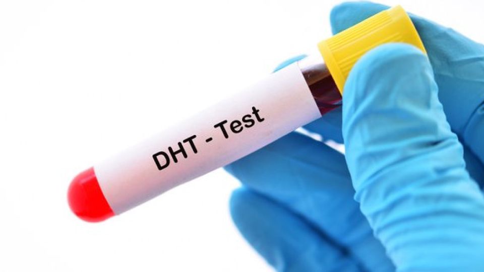 탈모, 탈모처방, 탈모약, 탈모약종류, 피나스테리드, 두타스테리드, 탈모원인, 비대면탈모약, 탈모치료, 탈모관리