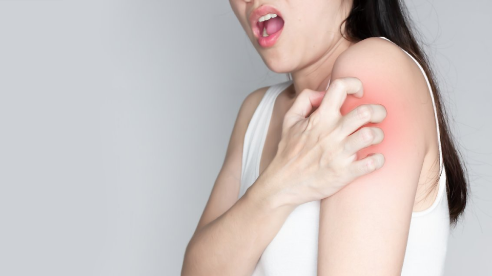 크레오신티, 여드름, 여드름약, 모공, 부작용