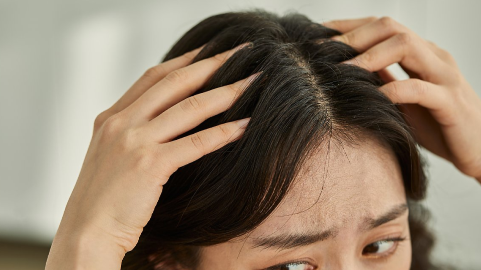 모발이식, 탈모치료, 부작용, 종류, 관리