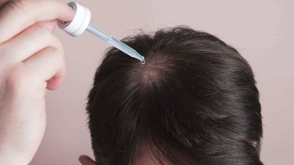 임신, 탈모, 탈모약, 태아, 남성