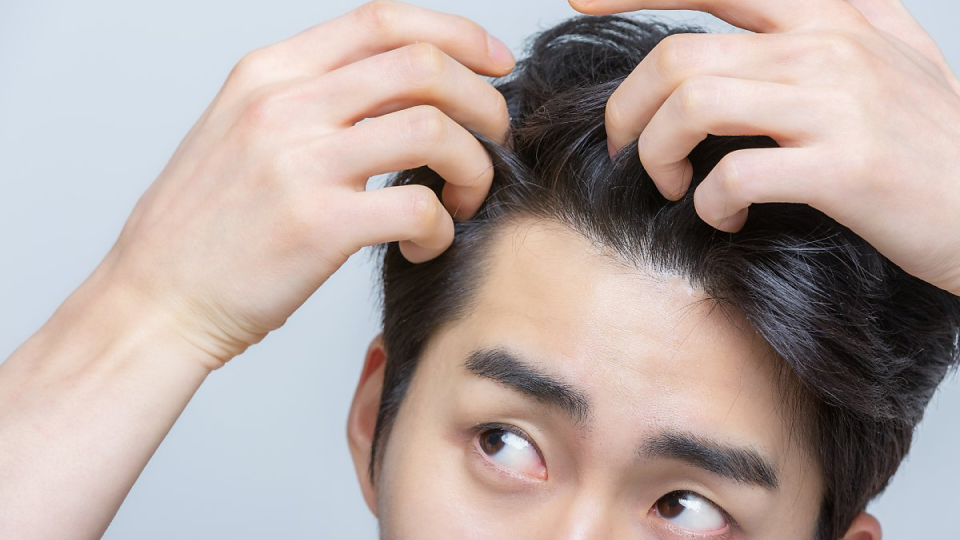 모발이식, 탈모치료, 부작용, 종류, 관리