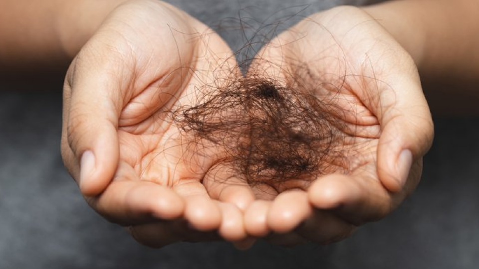 탈모, 환절기, 탈모원인, 병적탈모, 생리적탈모