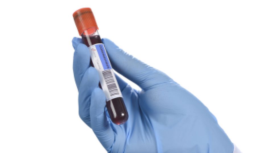 에이즈, 곤지름, 헤르페스, 임질, 매독, 클라미디아, 성병검사, 성병예방, 가다실, 가다실9가, 성병원인