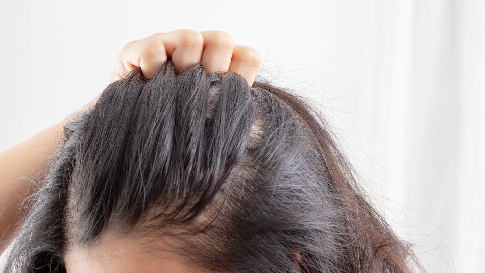 두피 염증, 모발 손상, 탈모