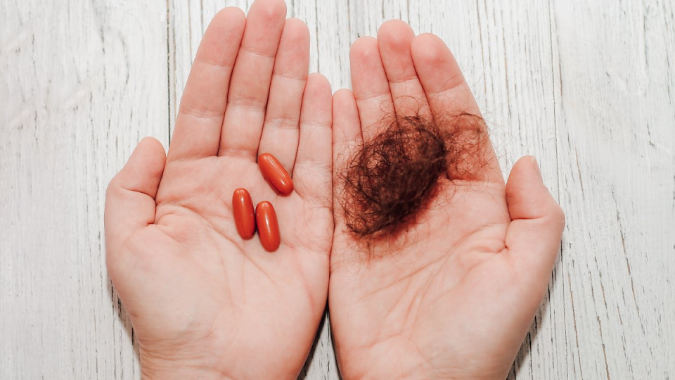 탈모, 탈모약, 처방, 피부과, 처방전