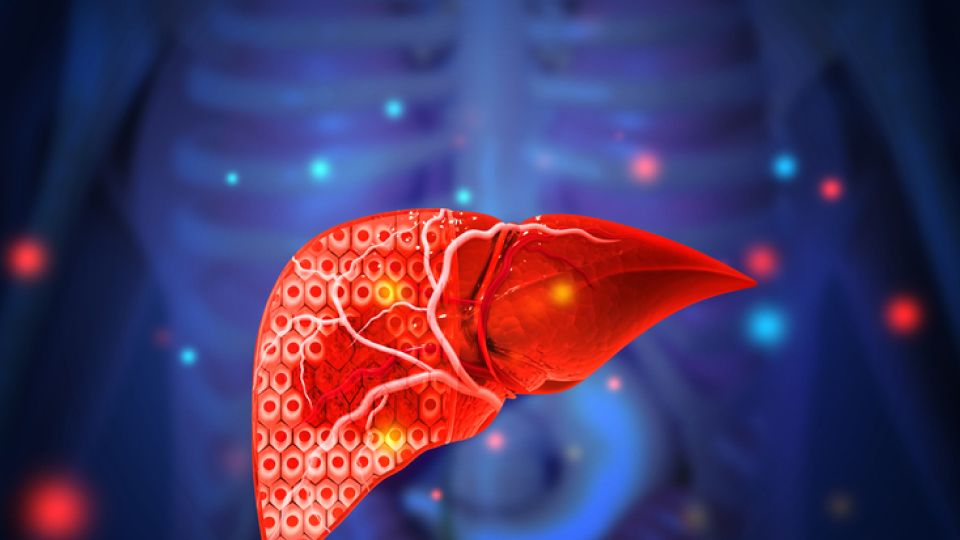 숙취해소, 숙취, 해장국, 숙취 원인, 초코우유