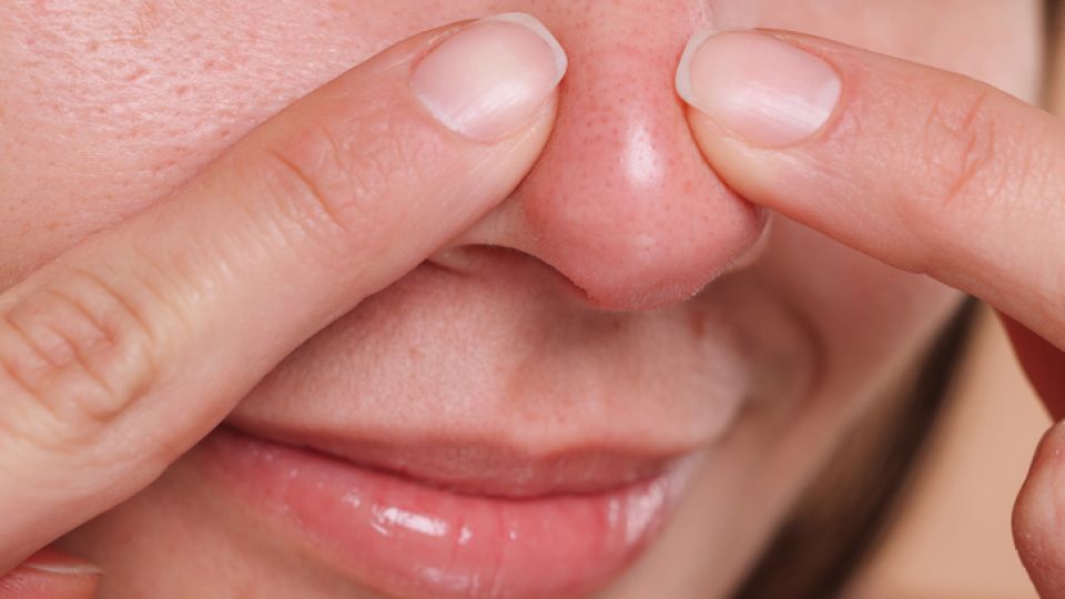 여드름, 여드름짜기