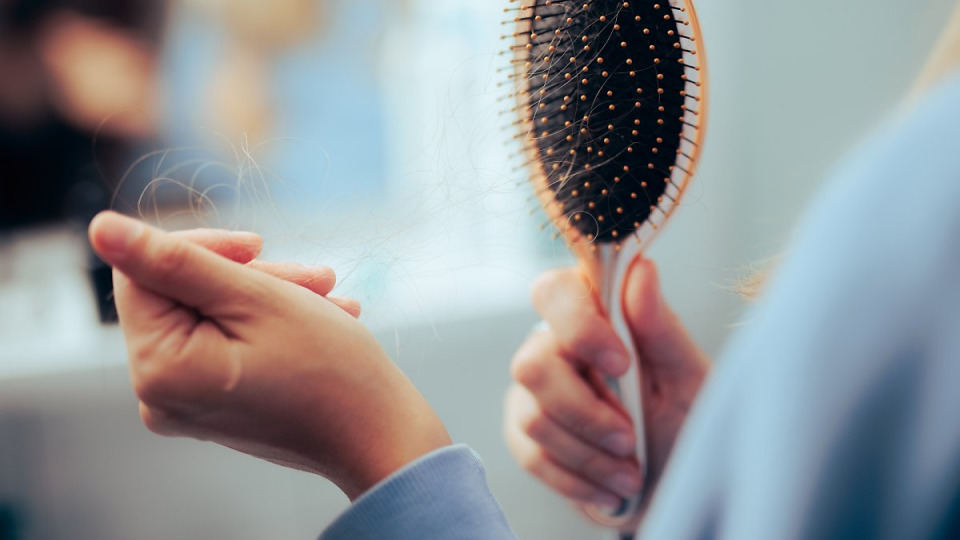 탈모, 유전, 자가진단, 스트레스, 모발