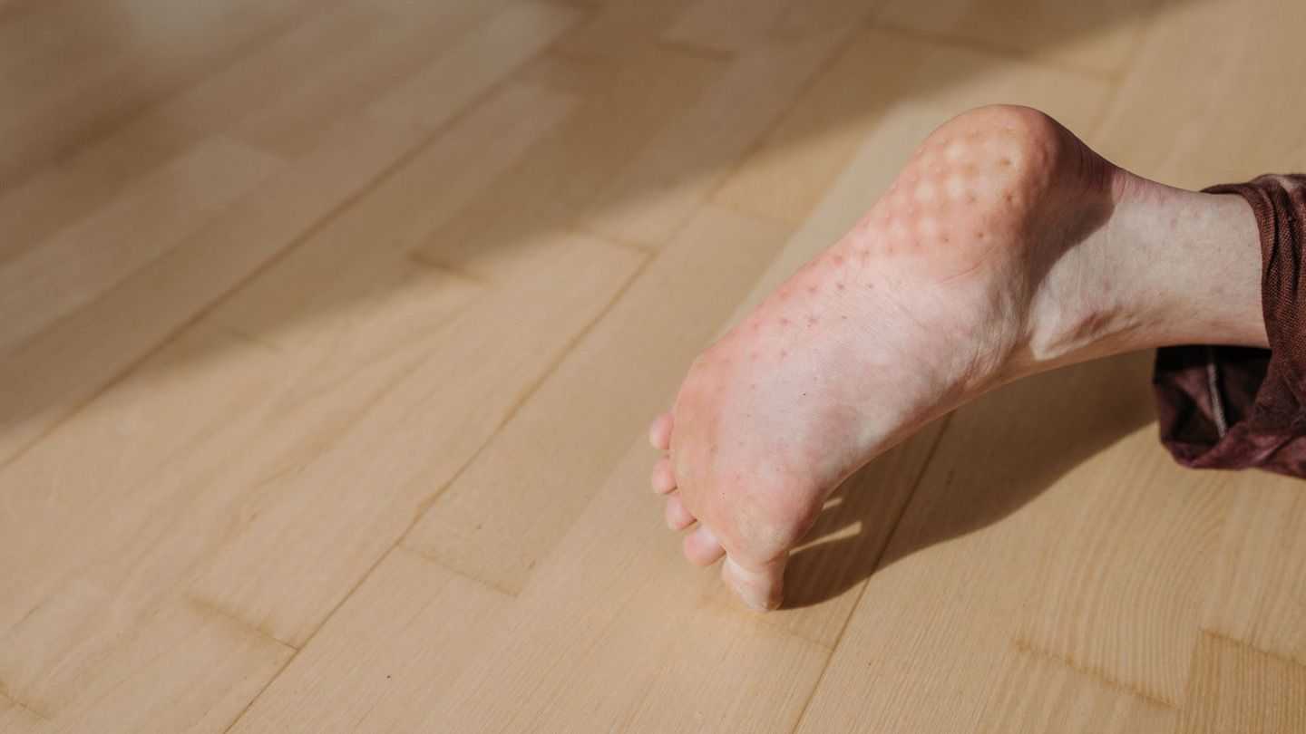 발바닥 피부 상태를 살펴보는 모습
