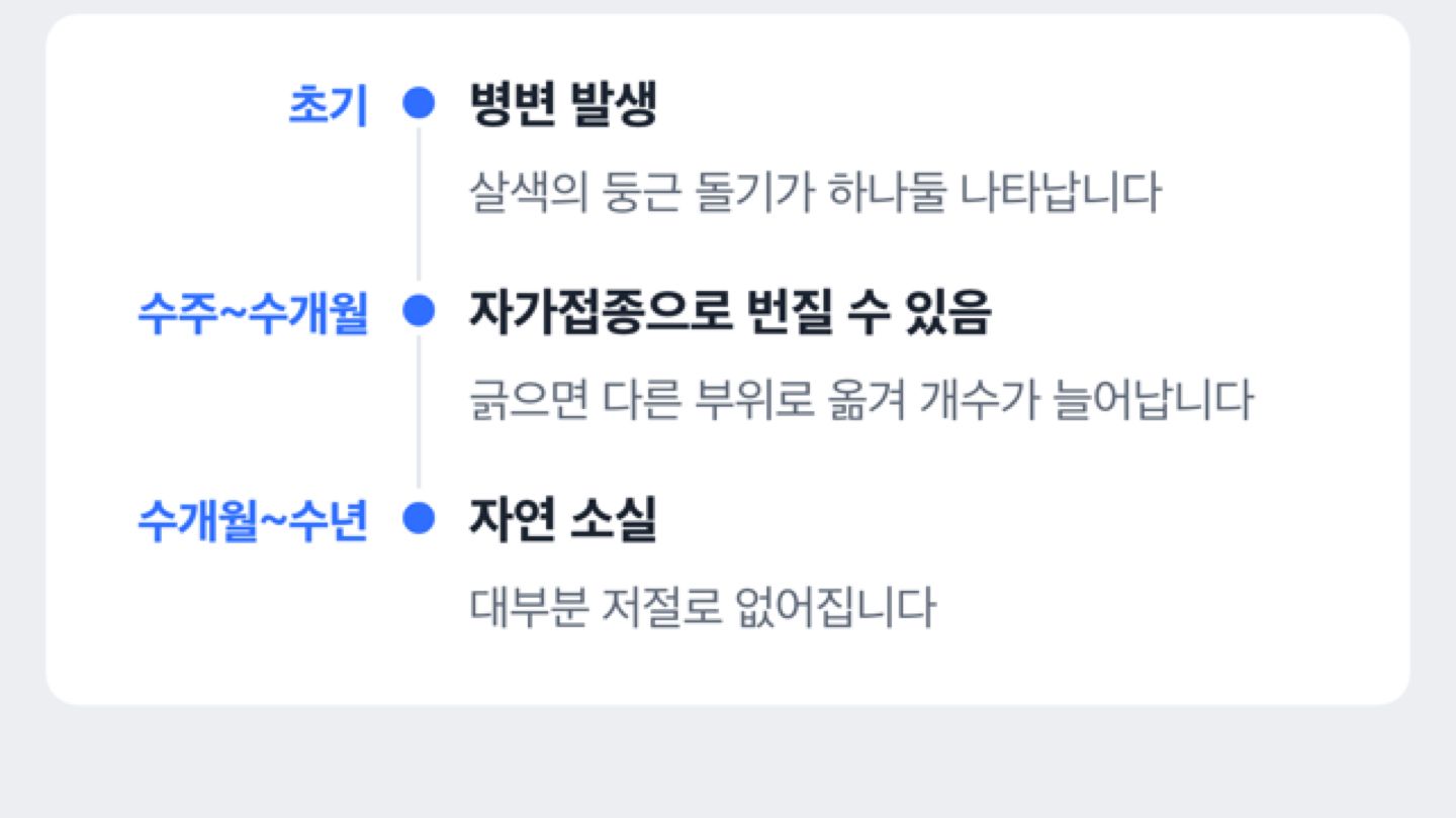 물사마귀 자연 경과 시점 흐름 도해