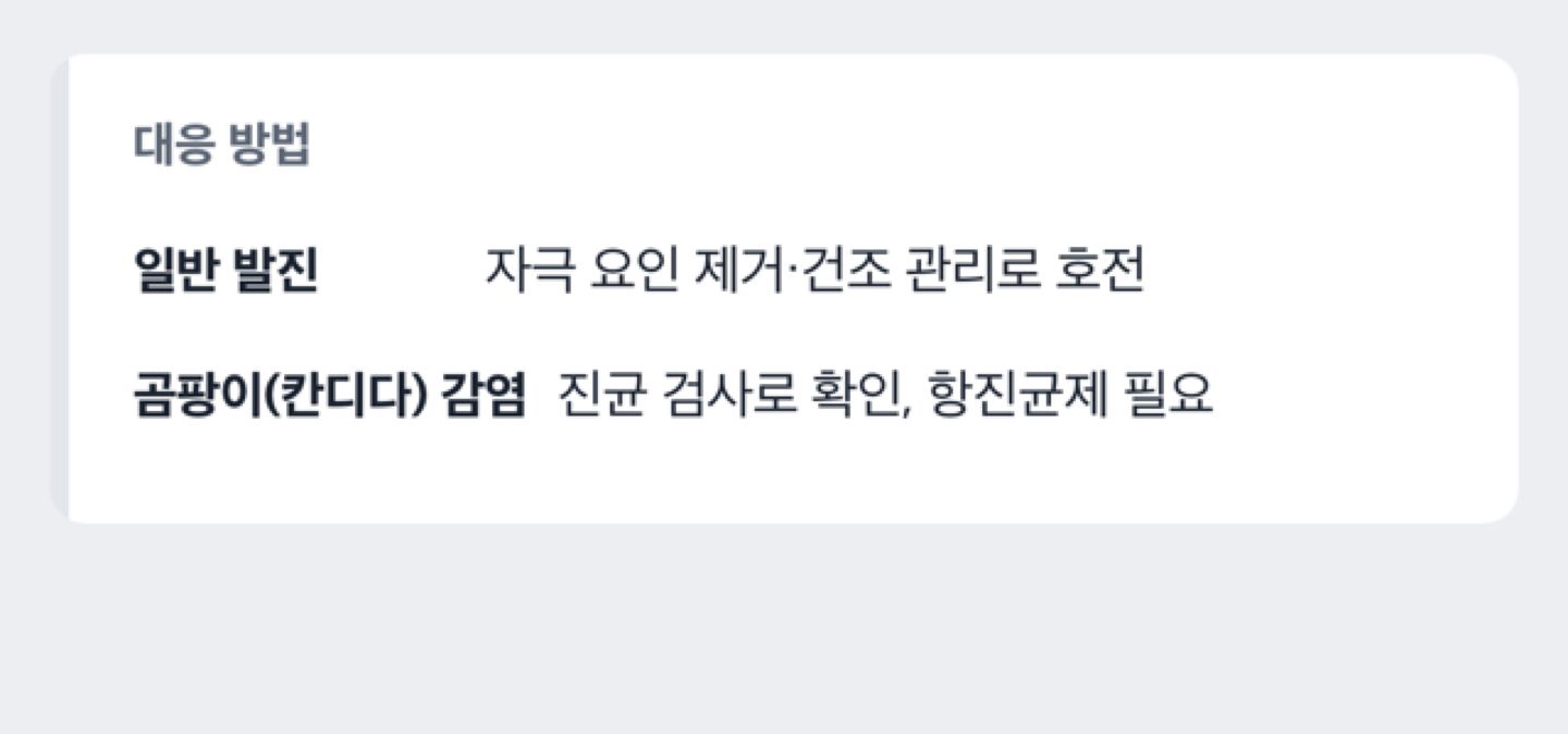 일반 자극성 발진과 곰팡이(칸디다) 감염의 대응 차이를 보여준다