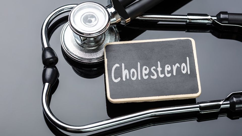 고지혈증진단, 고지혈증검사, 고지혈증치료, 고지혈증치료방법, 콜레스테롤낮추는방법, 콜레스테롤수치, 고지혈증치료제, ldl콜레스테롤